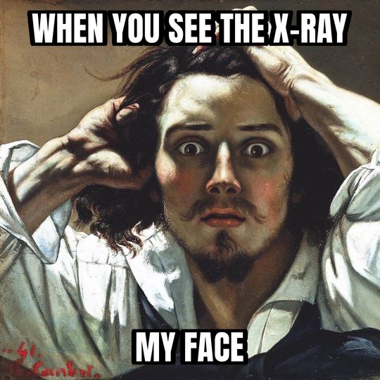 Desperate man meme: When you see the X-ray / My face